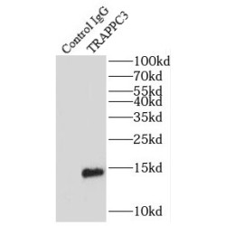 Trafficking Protein Particle Complex Subunit 3 (TRAPPC3) Antibody