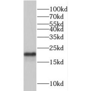 WB analysis of mouse liver tissue, using TRAPPC3 antibody (1/800 dilution).