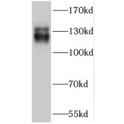 WB analysis of Neuro-2a cells, using Trappc9,NIBP antibody (1/300 dilution).