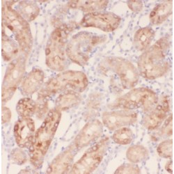 Trafficking Protein Particle Complex Subunit 9 (TRAPPC9) Antibody