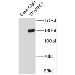 Trafficking Protein Particle Complex Subunit 9 (TRAPPC9) Antibody