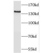 WB analysis of mouse brain tissue, using TRAPPC9, NIBP antibody (1/800 dilution).