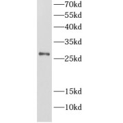 WB analysis of mouse thymus tissue, using TRAT1 antibody (1/500 dilution).