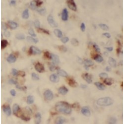 Trefoil Factor 1 (TFF1) Antibody