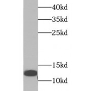 WB analysis of human kidney tissue, using TFF1 antibody (1/1000 dilution).