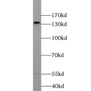 WB analysis of MCF7 cells, using TRERF1 antibody (1/300 dilution).