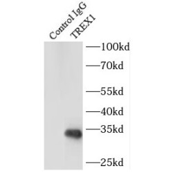 Three Prime Repair Exonuclease 1 (TREX1) Antibody