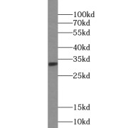 WB analysis of HeLa cells, using TREX1 antibody (1/300 dilution).