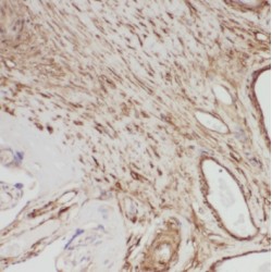 Tribbles Homolog 2 (TRIB2) Antibody