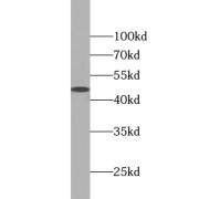 WB analysis of HeLa cells, using TRIB2 antibody (1/500 dilution).