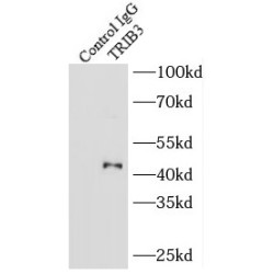 Tribbles Homolog 3 (TRIB3) Antibody