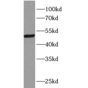 WB analysis of Jurkat cells, using TRIM15 antibody (1/500 dilution).