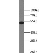 WB analysis of HeLa cells, using TRIM17 antibody (1/300 dilution).