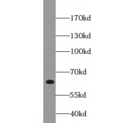 WB analysis of HeLa cells, using TRIM29 antibody (1/1000 dilution).