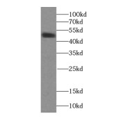 WB analysis of MCF-7 cells, using TRIM44 antibody (1/1000 dilution).