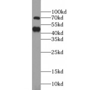 WB analysis of MKN-45 cells, using TRIM5 antibody (1/300 dilution).