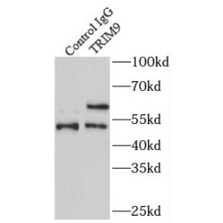 E3 Ubiquitin-Protein Ligase TRIM9 (TRIM9) Antibody
