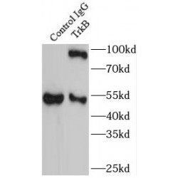 GP145-TrkB/GP95-TrkB (TrkB) Antibody