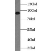 WB analysis of human cerebellum tissue, using NTRK2 antibody (1/400 dilution).