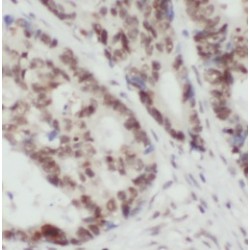 tRNA (guanine(26)-N(2))-Dimethyltransferase (TRMT1) Antibody