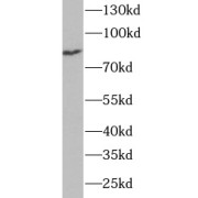 WB analysis of HeLa cells, using TRMT1 antibody (1/1000 dilution).