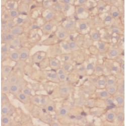 tRNA (guanine(10)-N2)-Methyltransferase Homolog (TRMT11) Antibody