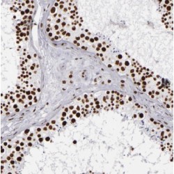 tRNA Methyltransferase 6 (TRMT6) Antibody