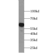 WB analysis of human brain tissue, using TRMT6 antibody (1/500 dilution).