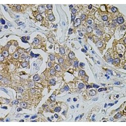 Transient Receptor Potential Cation Channel Subfamily A Member 1 (TRPA1) Antibody