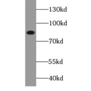 WB analysis of SH-SY5Y cells, using TRPC1 antibody (1/500 dilution).