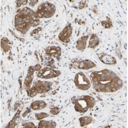 Short Transient Receptor Potential Channel 4-Associated Protein (TRPC4AP) Antibody