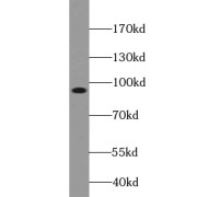 WB analysis of human heart tissue, using TRPC4AP antibody (1/300 dilution).