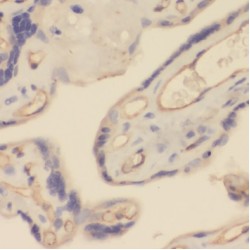 Transient Receptor Potential Cation Channel Subfamily C Member 6 (TRPC6) Antibody