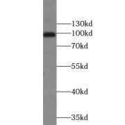 WB analysis of mouse brain tissue, using TRPC6 antibody (1/500 dilution).