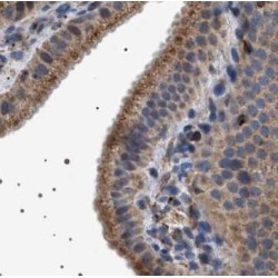 Probable tRNA Pseudouridine Synthase 2 (TRUB2) Antibody