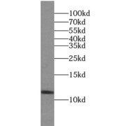 WB analysis of Jurkat cells, using TXN antibody (1/1000 dilution).