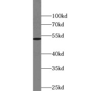 WB analysis of human brain tissue, using TSEN2 antibody (1/400 dilution).