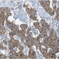 Elongation Factor Ts, Mitochondrial (TSFM) Antibody