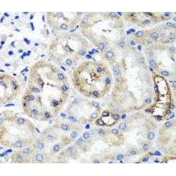 Tumor Necrosis Factor-Inducible Gene 6 Protein (TSG-6) Antibody