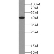 WB analysis of NIH/3T3 cells, using TNFAIP6 antibody (1/1000 dilution).