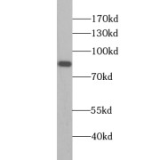 WB analysis of rat testis tissue, using TSGA10 antibody (1/1000 dilution).