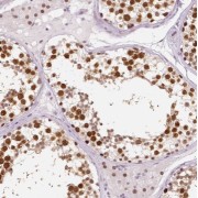 IHC-P analysis of human testis tissue, using TSGA13 Antibody (1/50 dilution).