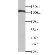 WB analysis of HeLa cells, using TSHR antibody (1/1000 dilution).