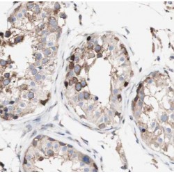 Translin (TSN) Antibody