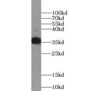 WB analysis of human brain tissue, using TSPAN11 antibody (1/800 dilution).