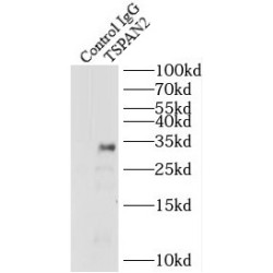 Tetraspanin 2 (TSPAN2) Antibody