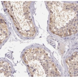 Testis-Specific Y-Encoded Protein 3 (TSPY3) Antibody