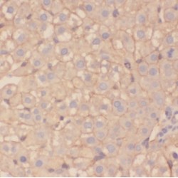 Pre-rRNA-Processing Protein TSR2 (TSR2) Antibody