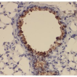 Tumor Suppressing Subtransferable Candidate 4 (TSSC4) Antibody