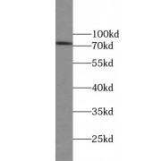 WB analysis of rat testis tissue, using TTC30A antibody (1/1000 dilution).